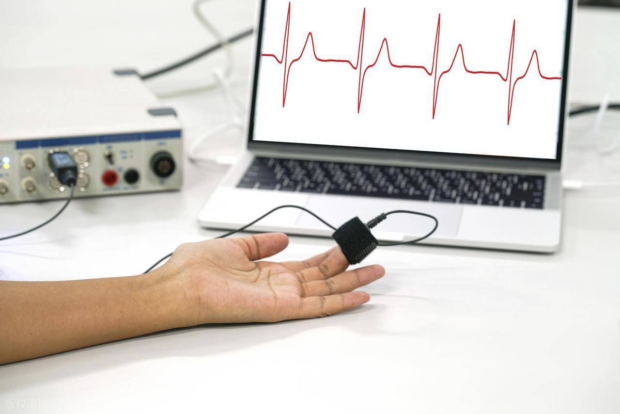 AIoT（智能物联网）：当物联网遇上机器学习